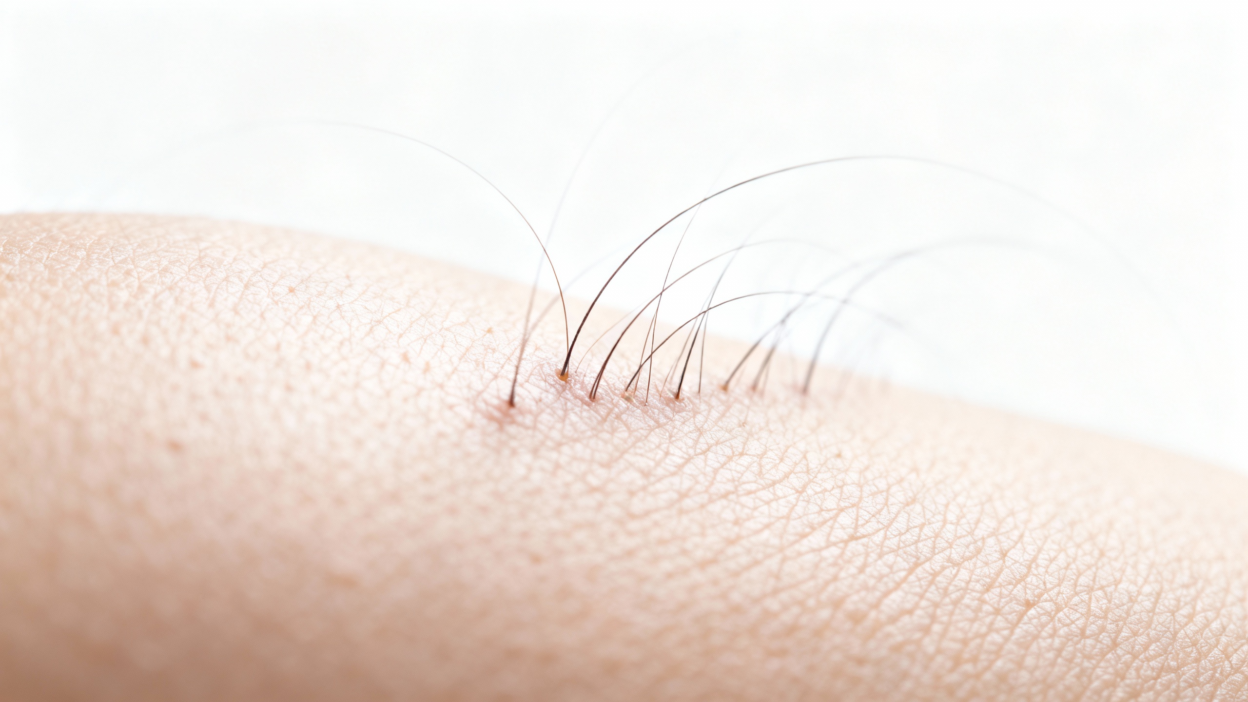 Featured image for What is scalp acne?